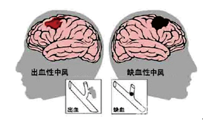 &#31859;&#20848;&#23448;&#26041;&#31449;&#32593;&#39029;&#29256;&#45;&#31859;&#20848;&#40;&#20013;&#22269;&#41;
