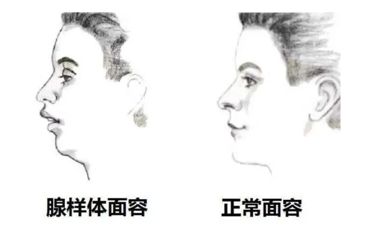 &#31859;&#20848;&#23448;&#26041;&#31449;&#32593;&#39029;&#29256;&#45;&#31859;&#20848;&#40;&#20013;&#22269;&#41;